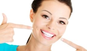 Несколько способов по отбеливанию зубов дома
